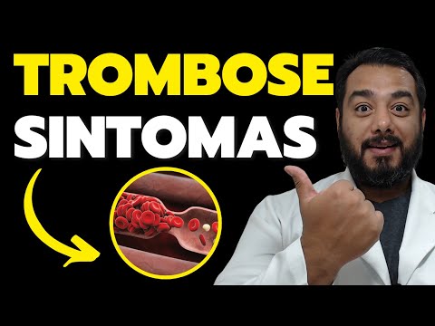 Quais os sintomas da trombose venosa profunda (TVP)? | Prof. Dr. Victor Proença – IBAP Cursos