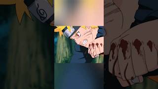 Download lagu Naruto's Rage On Gaara's Death ☠️ 😰 | Naruto's Deadly Punches on Deidara | #anime #naruto #punching mp3 Download lagu Naruto's Rage On Gaara's Death ☠️ 😰 | Naruto's Deadly Punches on Deidara | #anime #naruto #punching mp3