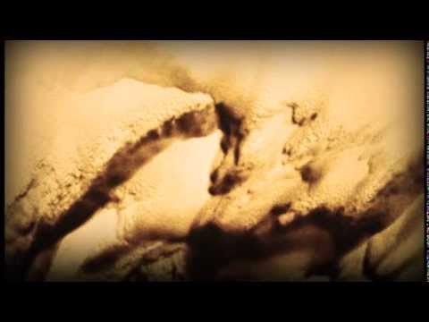 Me entregaré - La Única Esperanza 10/10 | Iglesia Adventista