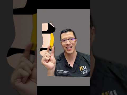 ¿Qué pasa con la grasa después de la abdominoplastia? | Nubody | #cirugíaplástica