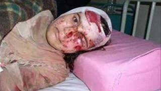 irak  Ska-p &quot;Tio Sam&quot;