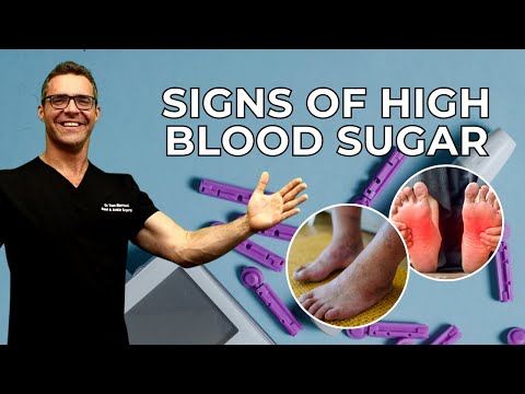 How to Lower Blood Pressure Causes Signs Symptoms What is it