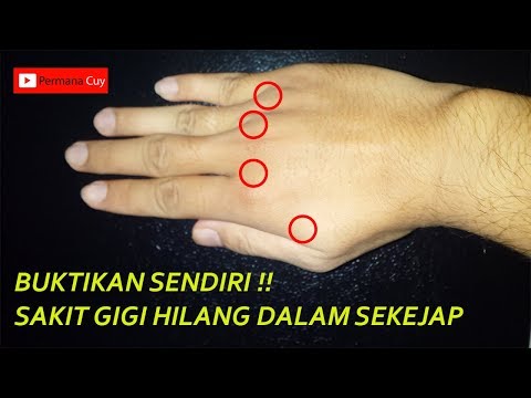 Cara Agar Cepat Tidur Saat Sakit Gigi, artikel Cara Agar Cepat Tidur Saat Sakit Gigi gratis, video trending Cara Agar Cepat Tidur Saat Sakit Gigi