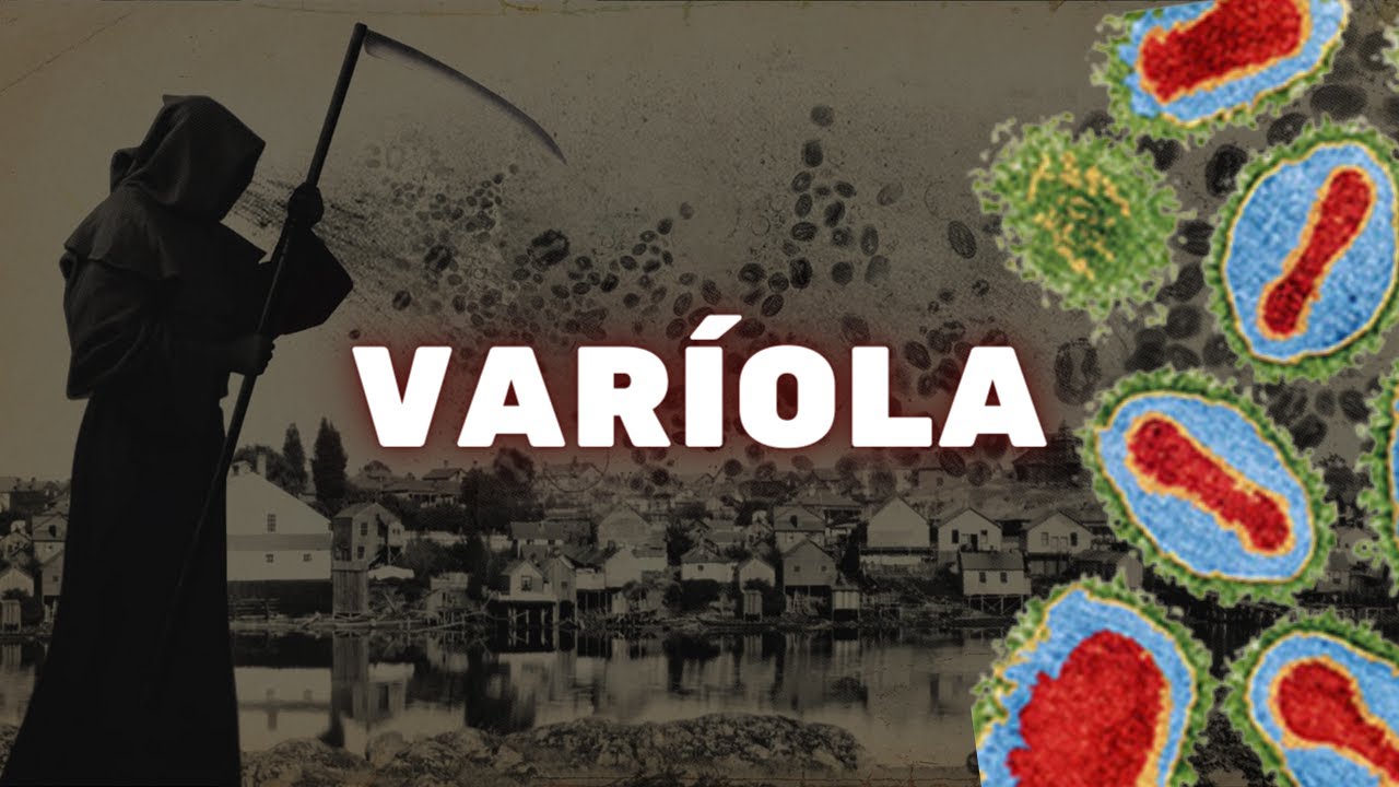 Varíola - a incrível história da doença que morreu - Fisiologia Humana