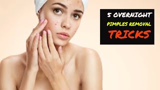 Overnight Face Pimple Removal – 5 Easy Pimples Removal Tricks