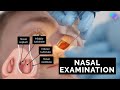 Nasal Examination | Nose Examination | OSCE Guide | UKMLA | CPSA