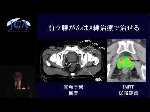 栄養学科 講演4「ここまで治せる最新放射線治療」 小口正彦（がん研究会有明病院放射線治療部・部長）