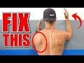 🐔 GOT CHICKEN WING SYNDROME? FIX Your Shoulders By Doing THIS!