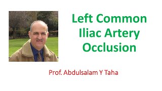 Left Common Iliac Artery Occlusion