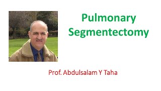 Pulmonary Segmentectomy