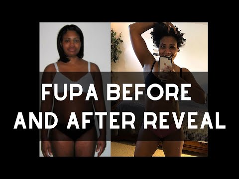 fogyni fupa