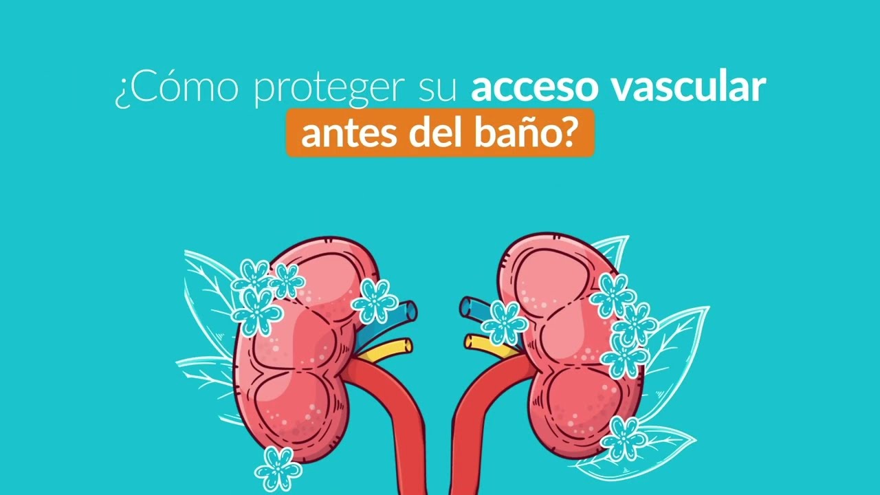 ¿Cómo proteger su acceso vascular antes del baño?