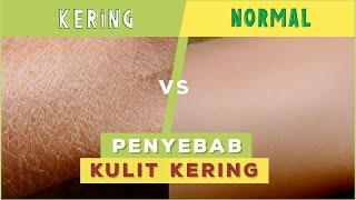 Download lagu Ternyata Inilah Penyebab Kulit Kering ! mp3