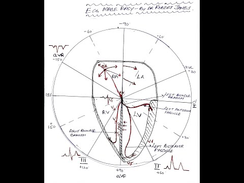 AXIS ECG MADE EASY Part 4