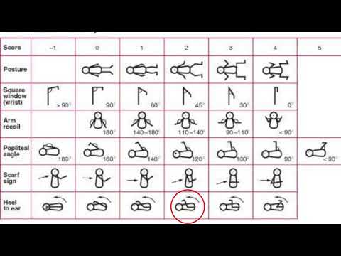 Pemeriksaan Ballard Score