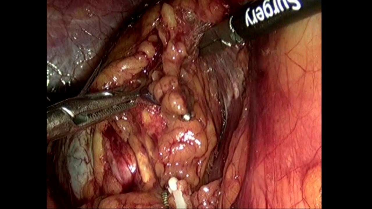 Gustavo Durán Hernández-12