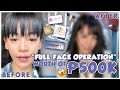 WORTH 500k FULL FACE OPERATION