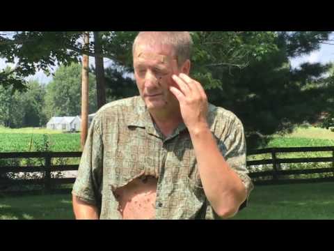 How Not To Destroy A Hornets Nest! Man Gets Stung Multiple Times! Burnt & Stung!