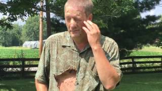 How Not To Destroy A Hornets Nest! Man Gets Stung Multiple Times! Burnt &amp; Stung!