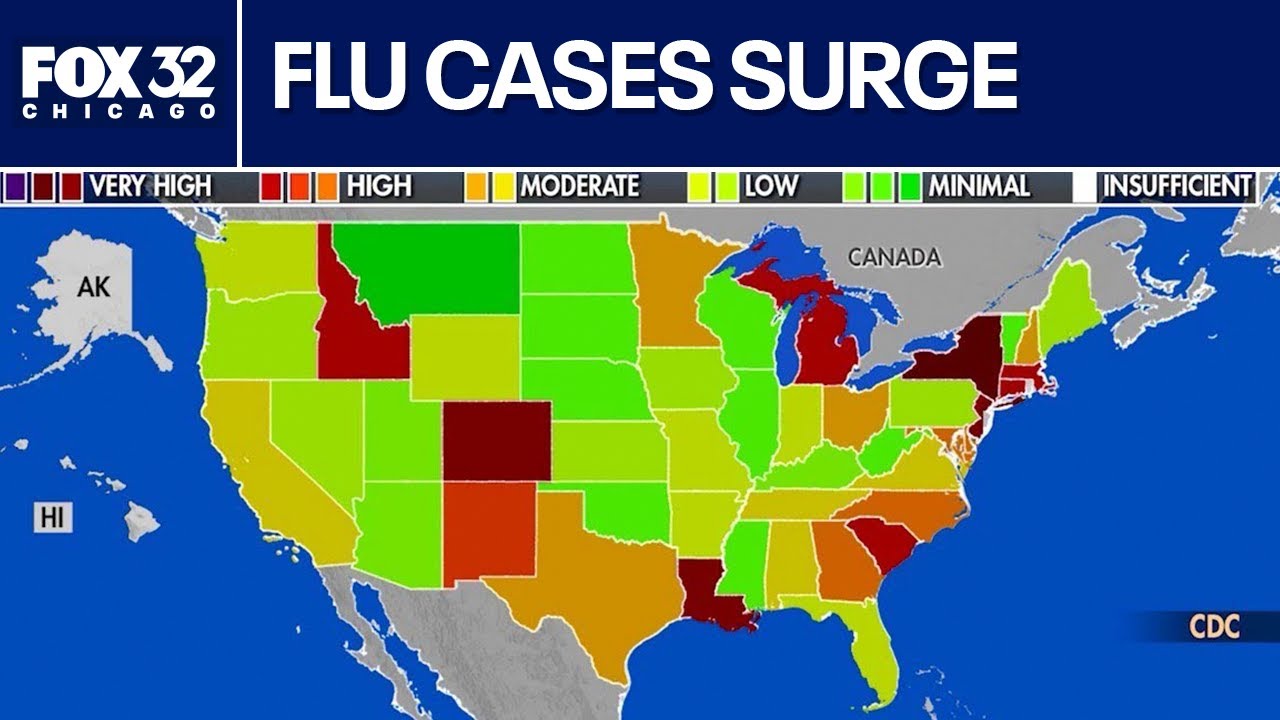 Flu cases surging nationwide