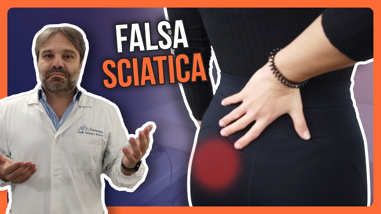 FALSA SCIATICA | Perchè il DOLORE AL GLUTEO non GUARISCE e RITORNA SEMPRE, Trattamento OSTEOPATICO