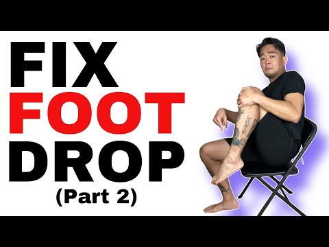 Foot Drop Treatment Part 2