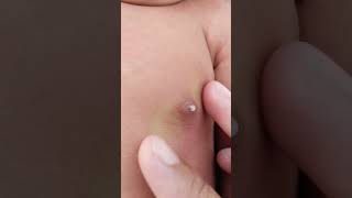 Download lagu BAYI MENGELUARKAN ASI, simak penjelasannya mp3 Download lagu BAYI MENGELUARKAN ASI, simak penjelasannya mp3