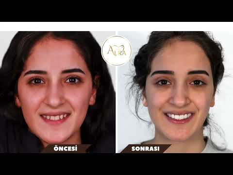 Aura Tanıtım 5 Saat