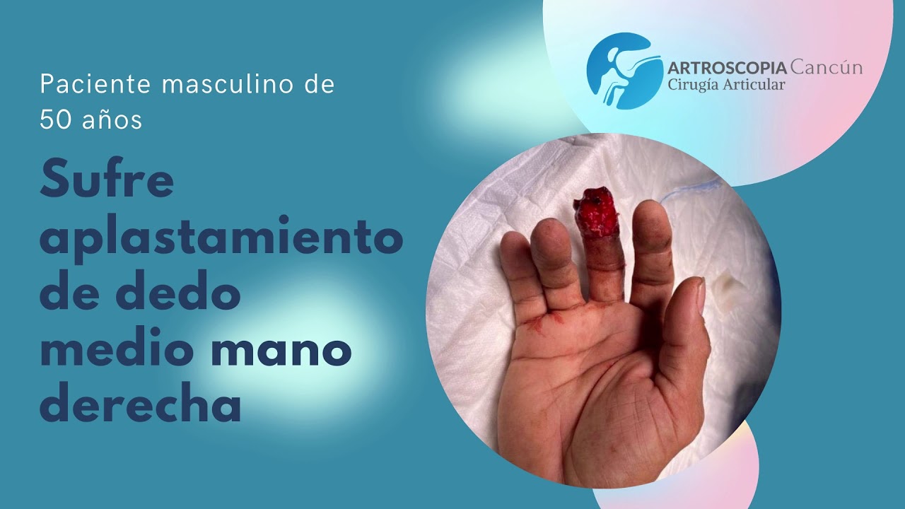 Fernando Ortiz Romero-20