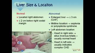 STABLE Cardiac Part I