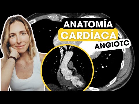 Todo lo que tienes que saber sobre anatomía cardíaca por TC!✅