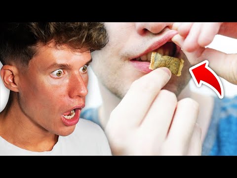 SNUS - Die LEGALE Superdroge 💊😳