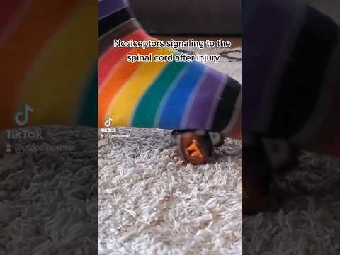 ouch #neuroscience #painneuroscience #neurons #pain #nociceptor #nociception #biology