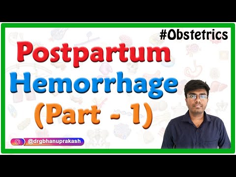 𝐏𝐨𝐬𝐭𝐩𝐚𝐫𝐭𝐮𝐦 𝐇𝐞𝐦𝐨𝐫𝐫𝐡𝐚𝐠𝐞 - part 1 || Obstetrics & gynaecology