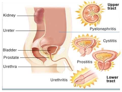 Medizin arthritische Gelenke an den Fingern Teil der Sammlung des Klosters von Osteochondrose