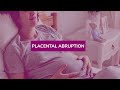 Placental Abruption Birth Injury and Complications