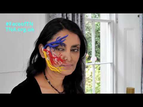 The Face of Trigeminal Neuralgia