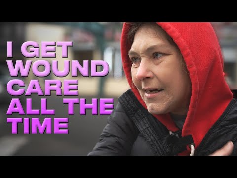 "The Skin On My Legs Is Gone From Tranq." | A drug addict interview in Kensington, PA. (4K)