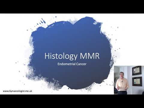 Endometrial cancer lecture 1