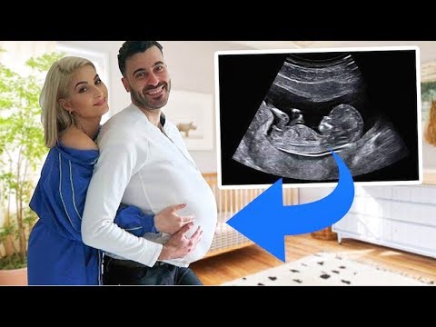 Il passe 24h enceint