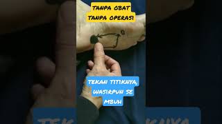 Download lagu tanpa obat ,cukup tekan titiknya. wasir sembuh #wasirsembuh #shorts #shortsvidio #lukiafandi mp3