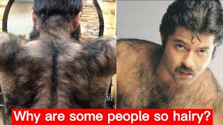 Download lagu Why are some people so hairy? #shorts mp3