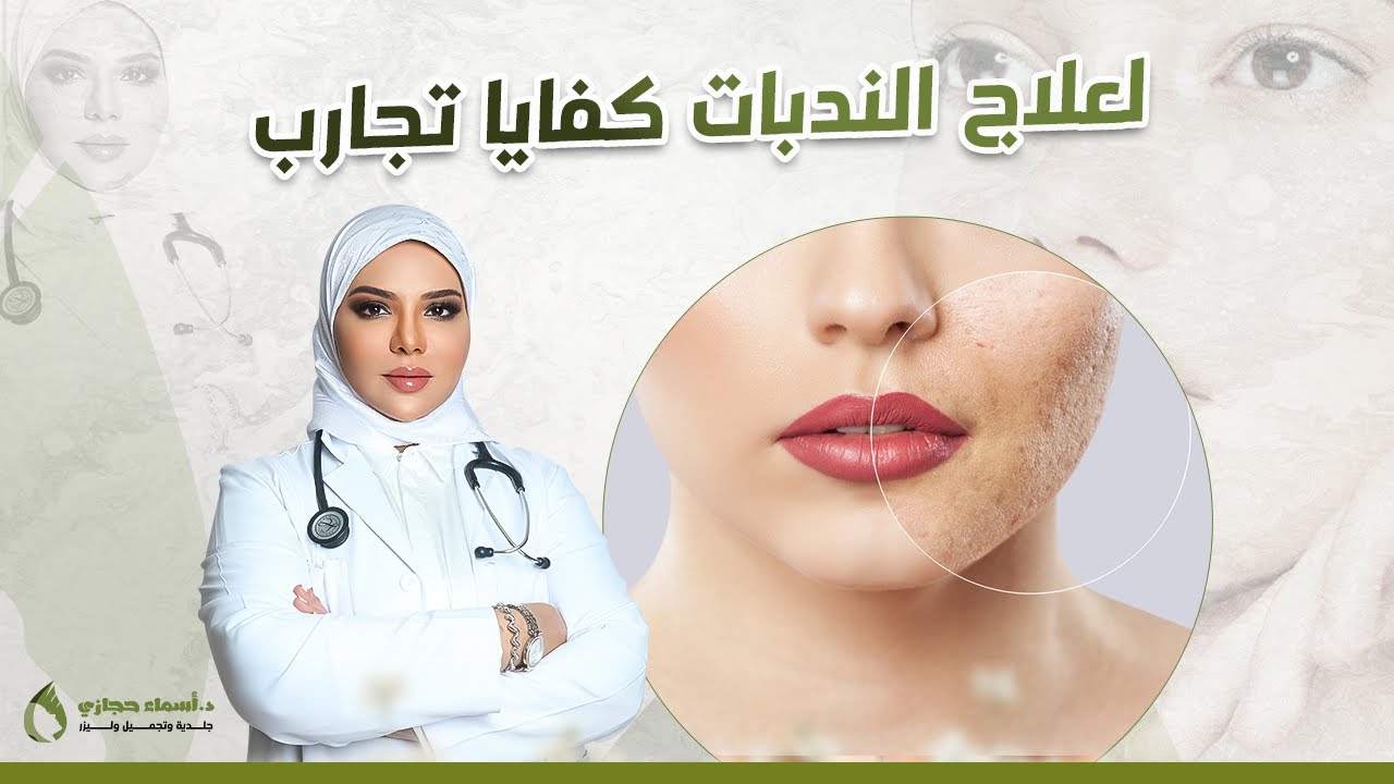 علاج الندبات أحدث طرق العلاج بنتائج سحرية تخلصي من الندبات العميقة نهائيا | دكتور أسماء حجازي