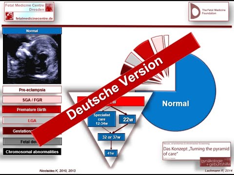 Dr. Robert Lachmann / Fetal Medicine Centre / Feindiagnostik /Ersttrimesterscreening