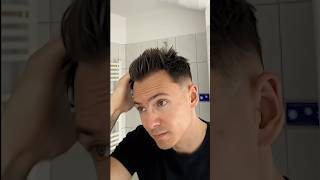Cosmedica Clinic Hair Transplant in Turkey Results #beforeafter #hairt