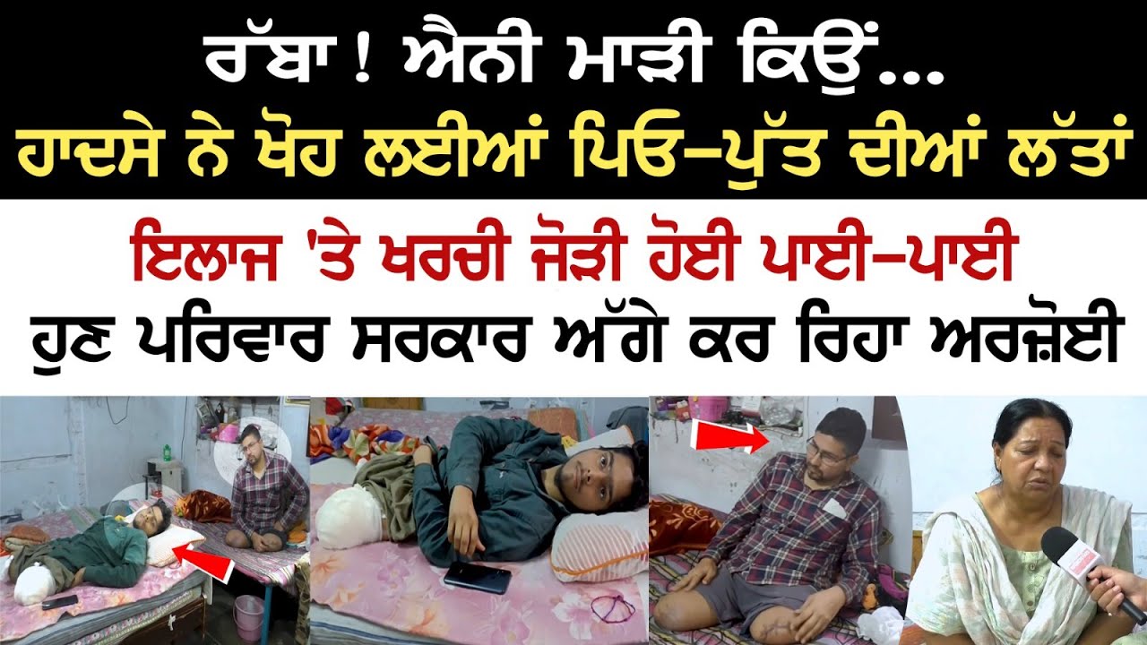 Father & Son lost their legs in an accident, All the savings spent on the cost of the treatment, See Video Father & Son lost their legs in an accident, All the savings spent on the cost of the treatment, See Video