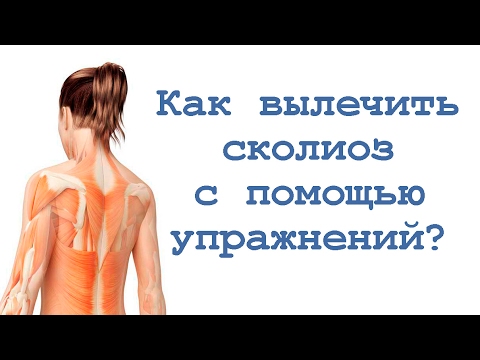 Массаж при искривлении позвоночника у ребенка Какой поясничный корсет лучший