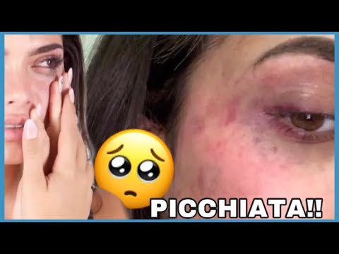 GIULIA PAGLIANITI P1CCH1ATA DAL SUO EX!! IL SUO RACCONTO!
