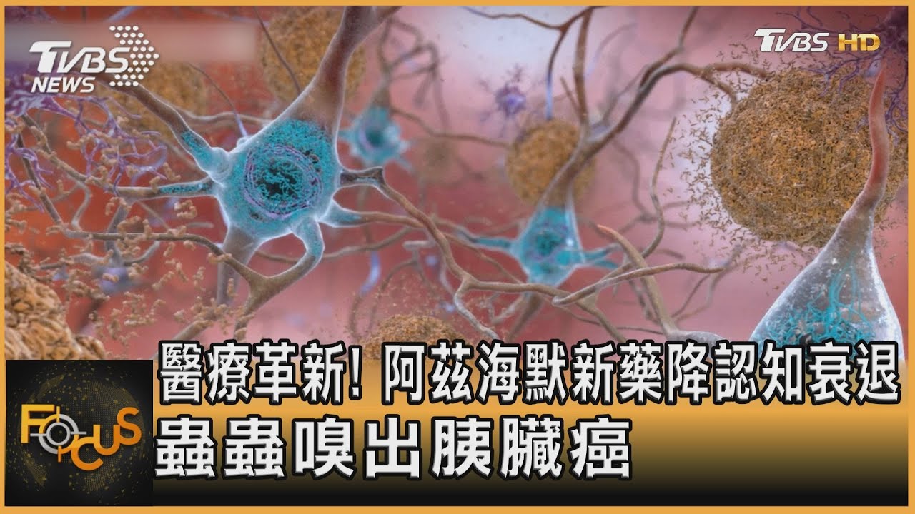 醫療革新!阿茲海默新藥降認知衰退 蟲蟲嗅出胰臟癌