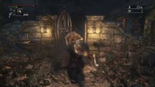 [初見実況]Blood borne#10[禁域の森]